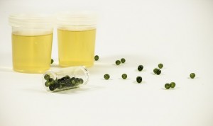 urine test